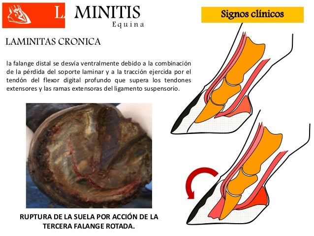 Laminitis equina