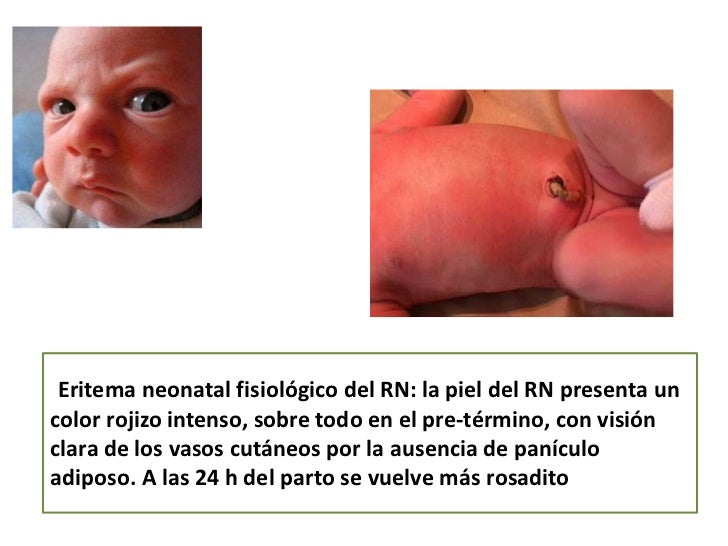 Como se librará rápidamente de las manchas de pigmento sobre la persona rápidamente