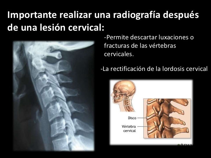 La inflamación del vientre del dolor en los riñones tira el vientre