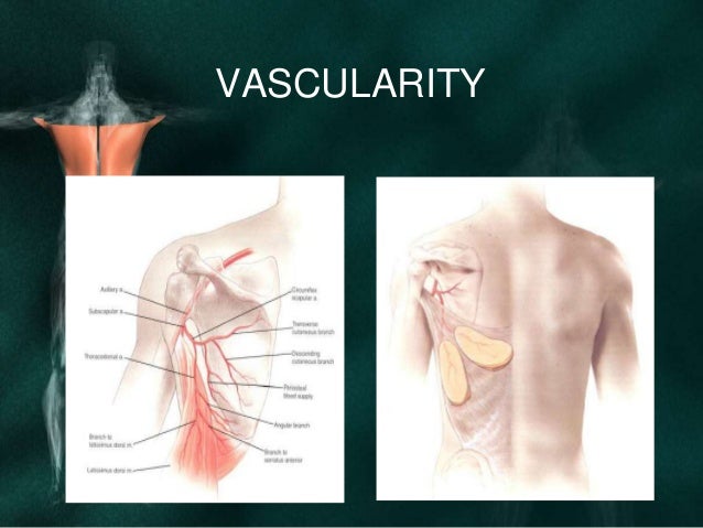 Latissimus dorsi flap for reconstruction in head and neck deffects