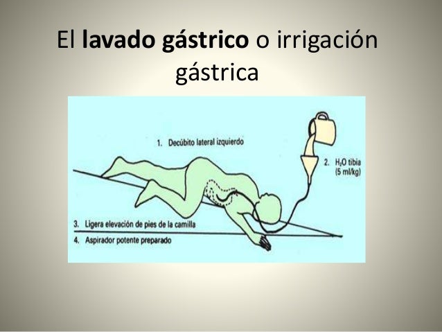 Lavado gastrico