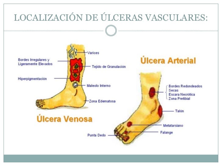 super reductor de peso y talla spa vg salud super reductor de peso y talla spa vg salud