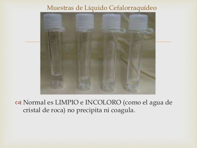 Liquido cefalorraquideo semiologia