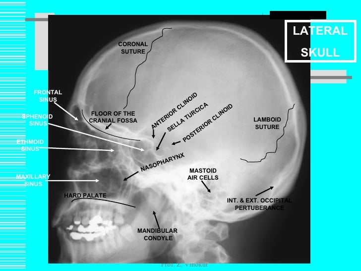 Lec1222509slideshare