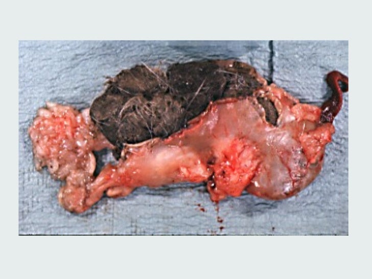 Is It Safe To Groom A Dog With Ringworm Is It Safe To Groom A Dog With Ringworm