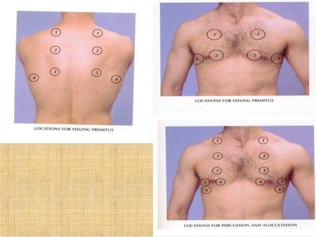 usmle practice test auscultation vsd usmle practice test auscultation vsd