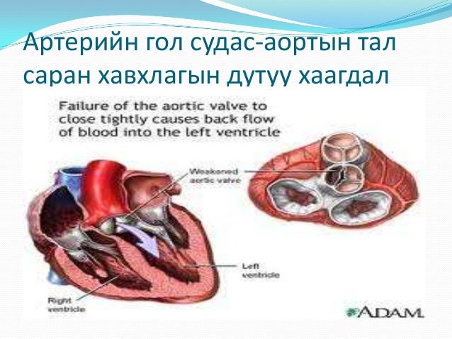 Lecture 11