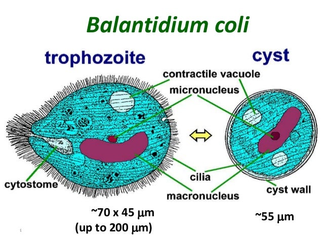 Resultado de imagen para balantidium coli