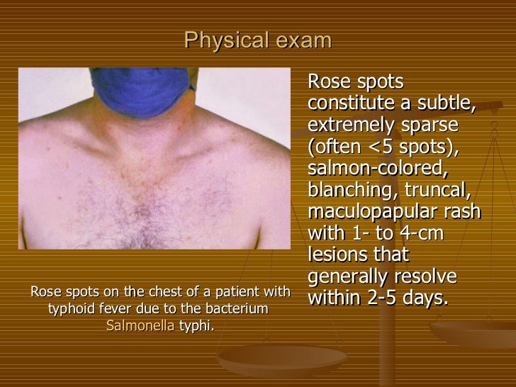 Lecture 5. typhoid fever 3