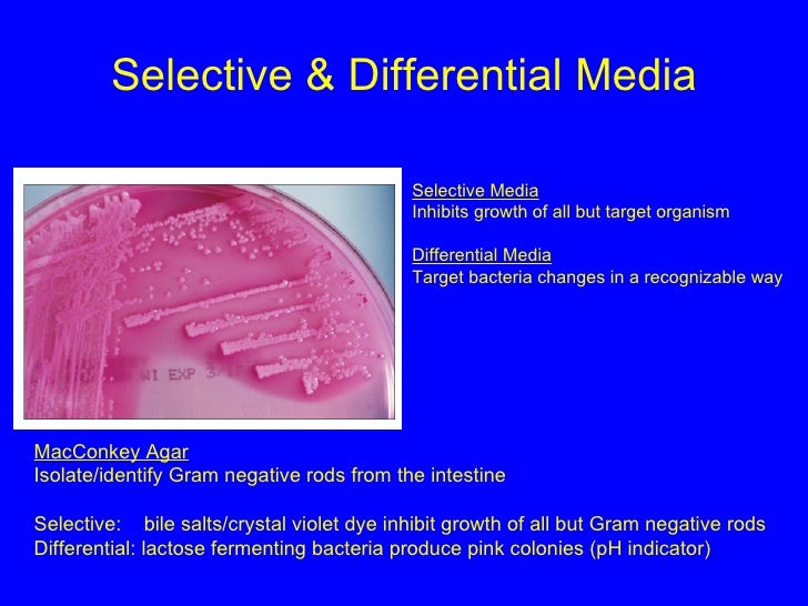 Selective vs differential agar image