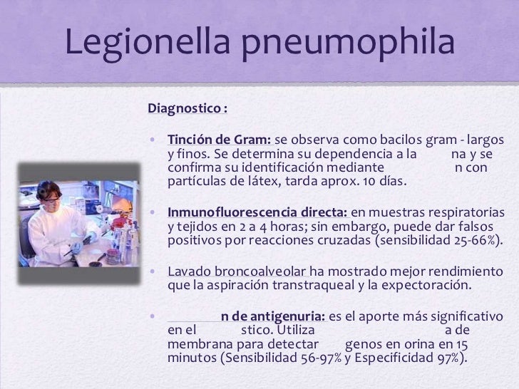Legionella pneumophila