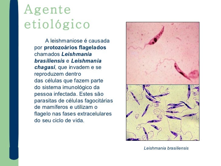 A Doença Descrita Nesse Texto é Causada Por