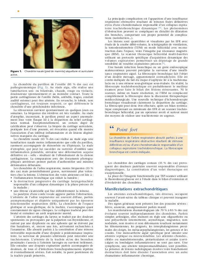 comment soigner ostéochondrite cheville