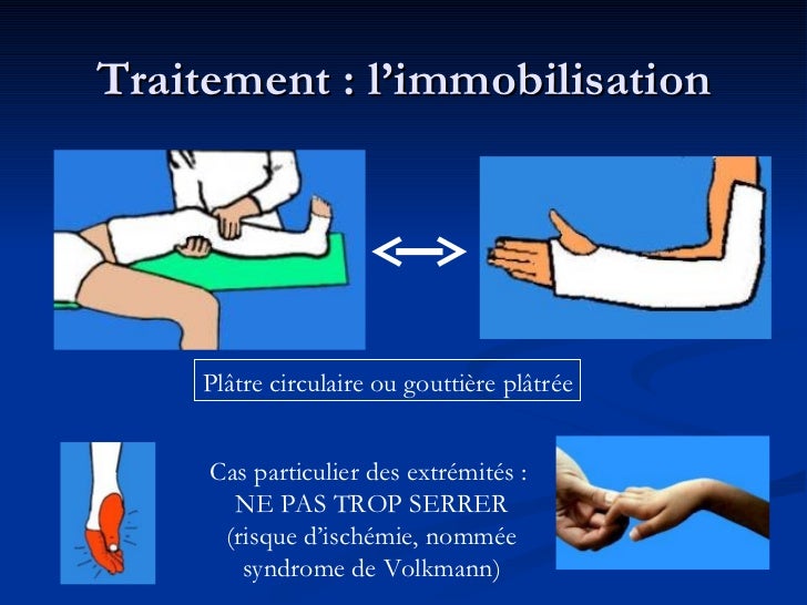 Les fractures osseuses