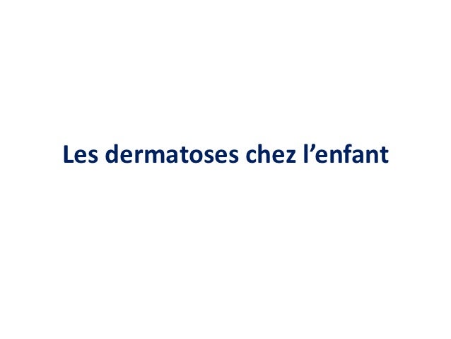 Lanalyse sur les helminthes et les protozoaires
