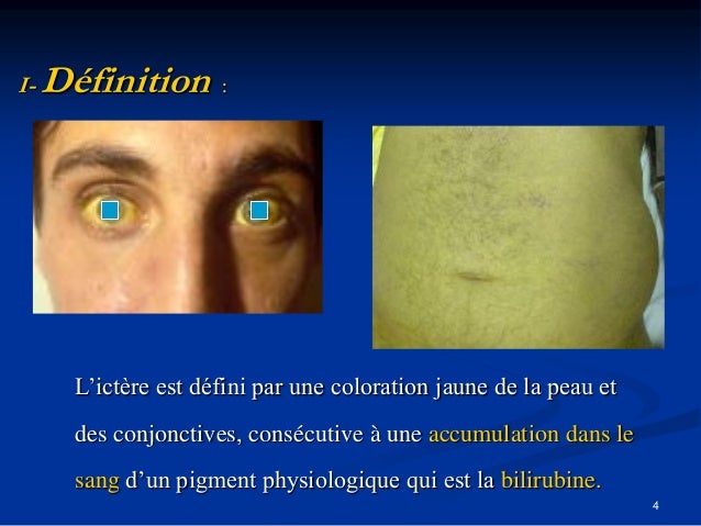 Lhuile éloignant les taches de pigment