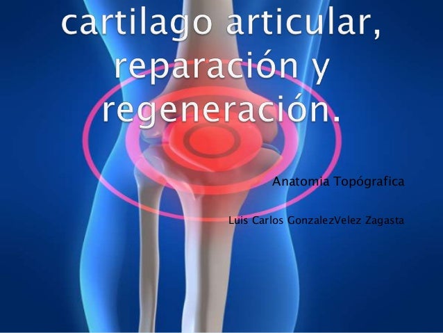 LESION CARTILAGO ARTICULAR lesion cartilago articular: