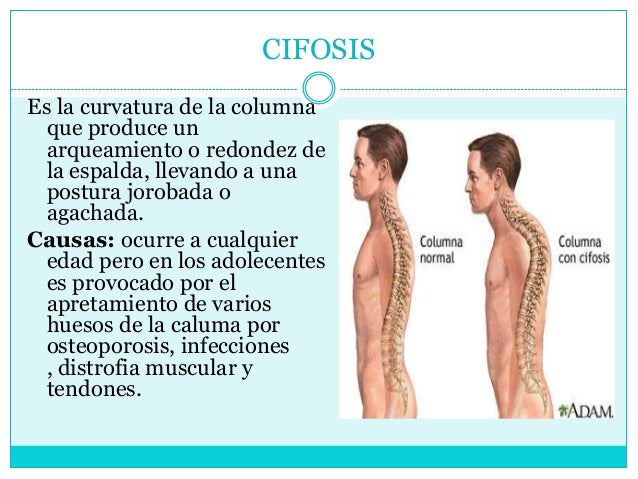 Los pies se ponen azul de la osteocondrosis