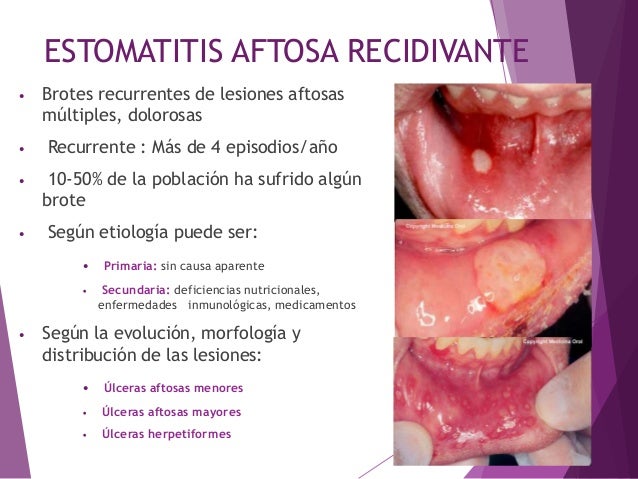 Lesiones de la mucosa oral