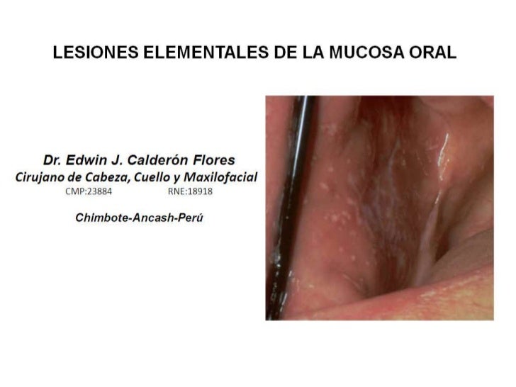 La Mucosa Oral 3