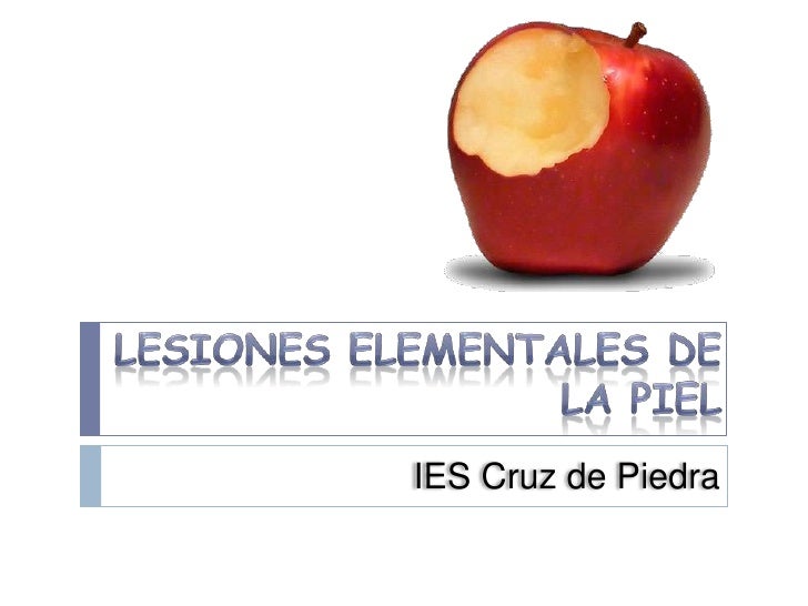 LESIONES ELEMENTALES EN LA PIEL lesiones elementales en la piel:
