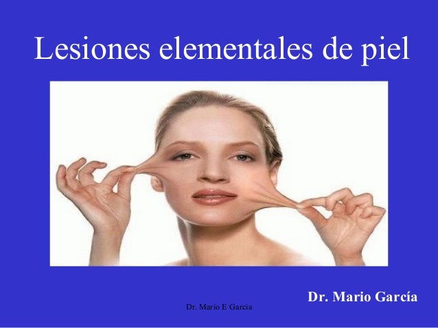 LESIONES ELEMENTALES EN LA PIEL lesiones elementales en la piel: