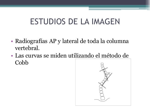 Dorsopatiya sheynogo del departamento de la columna vertebral crónico