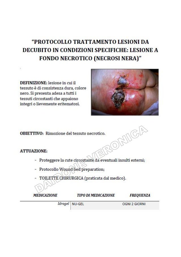 Lesioni da decubito