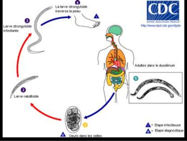 Le traitement nejrodermita le temps de la grossesse