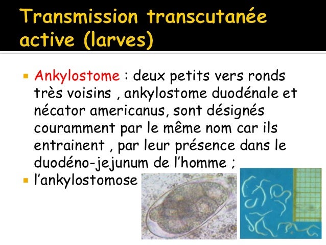 Lanalyse du sang les helminthes des queues