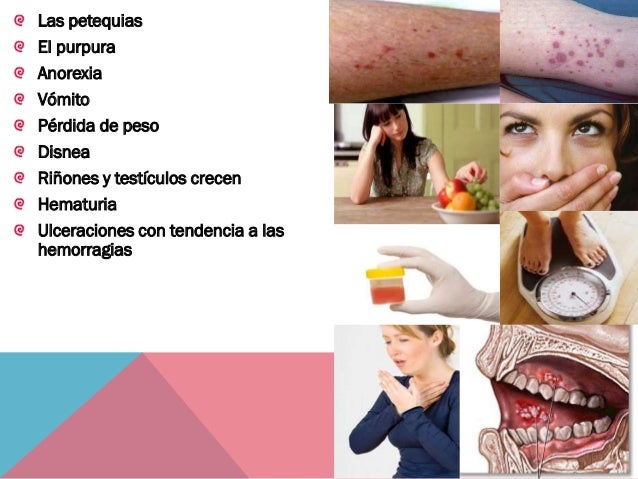 Los dolores en lo bajo del vientre y los riñones a la demora mensual
