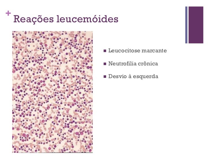 Leucograma Anclivepa 2011 Leucograma Anclivepa 2011