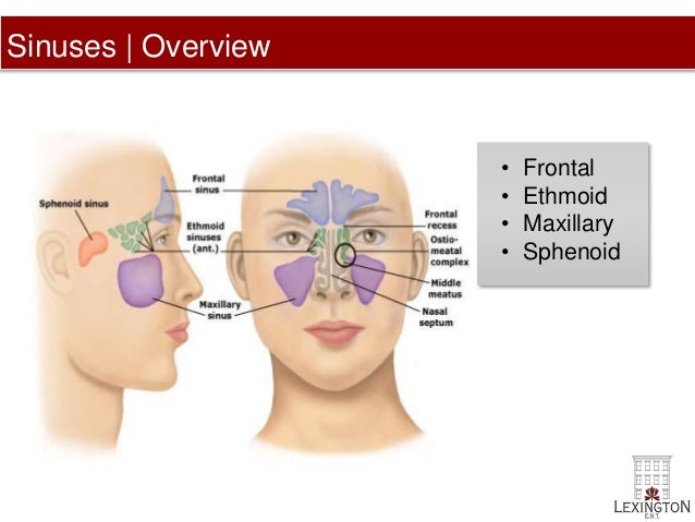 The way to relieve sinus ache in eye pilonidal cyst glue remedy