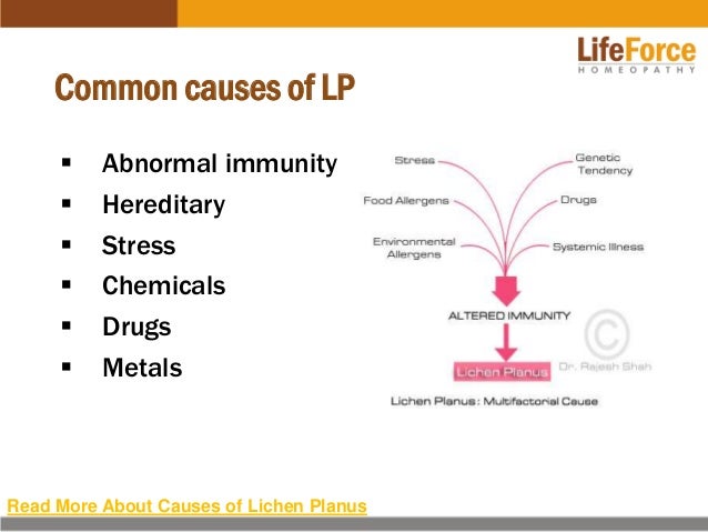 Oral Flutamide Hair Loss