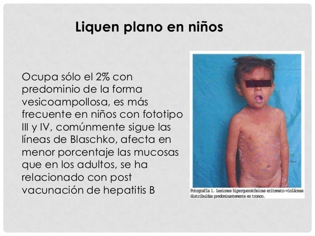 El nombre de los ungüentos del hongo de los pie