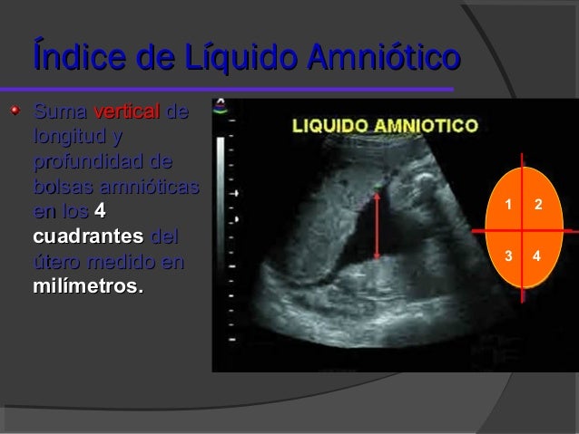 Liquido amniotico