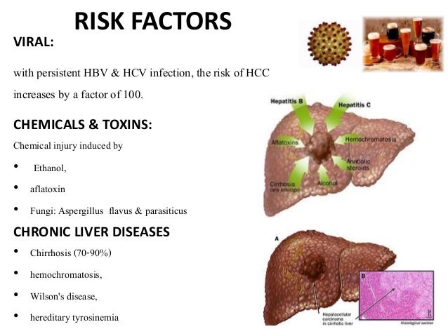 liver transplantation essay liver transplantation essay
