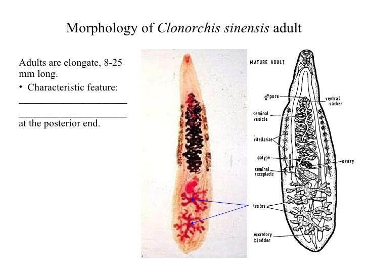 Liver Trematodes