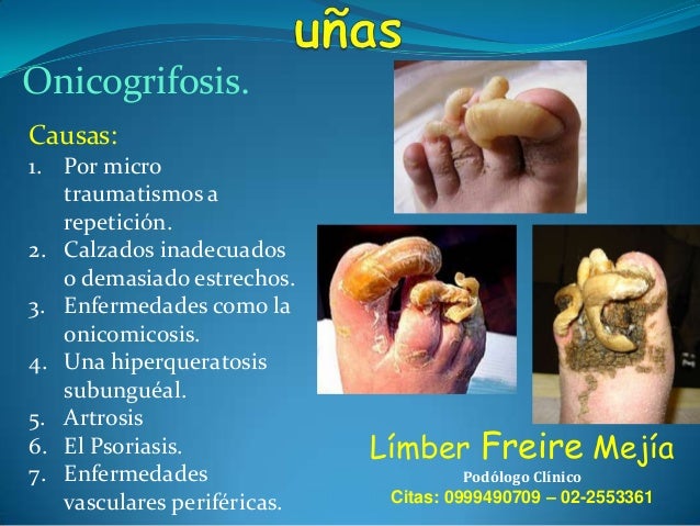 Los ungüentos de atopicheskogo de la dermatitis de la foto