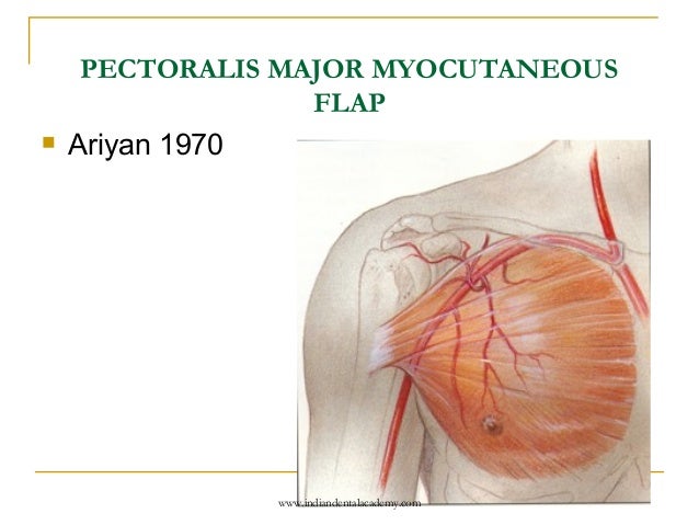 Local and regional flaps in head and neck cancer /certified fixed ort…