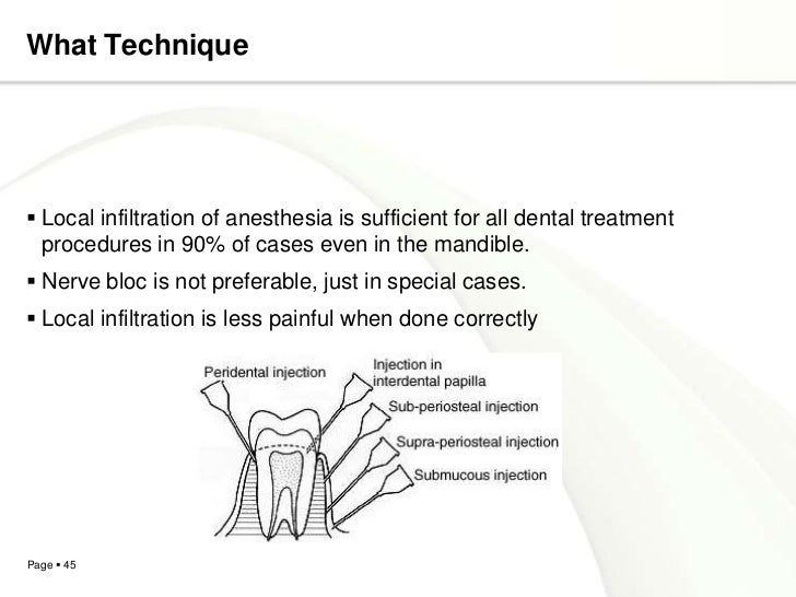 Local anesthetics agents