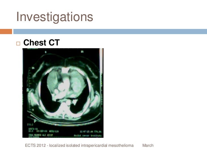peritoneal pleural mesothelioma