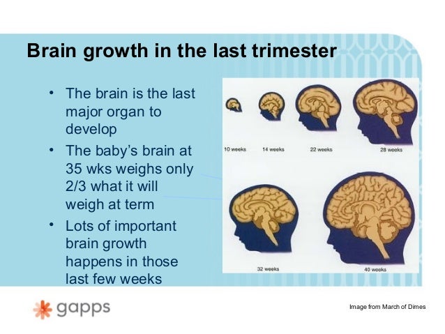 the risk of cerebral palsy in infants due to the effects of multiple births Risk of cerebral palsy in term-born singletons according to growth status confounding by preterm and/or multiple births was minimized by restricting the analyses. the risk of cerebral palsy in infants due to the effects of multiple births Risk of cerebral palsy in term-born singletons according to growth status confounding by preterm and/or multiple births was minimized by restricting the analyses.