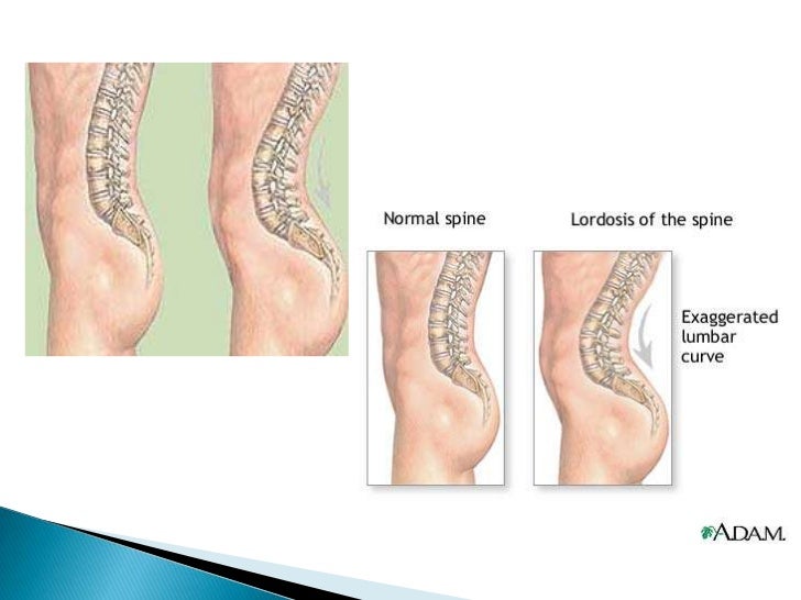 La gimnasia médica a la osteocondrosis de la columna vertebral por bubnovskomu