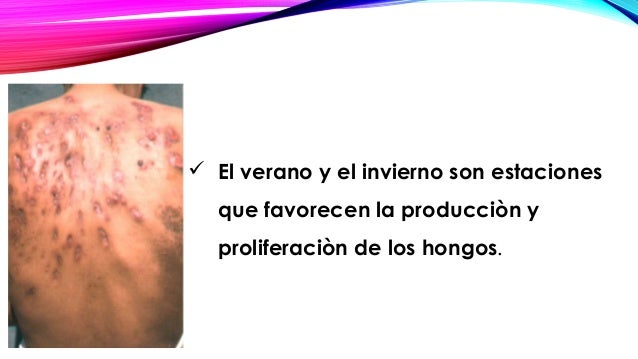 El ungüento contra el hongo en el pie del precio