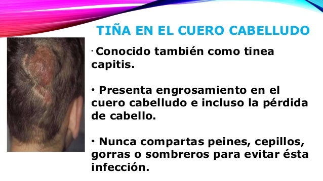 El medio de la profiláctica del moho y el hongo