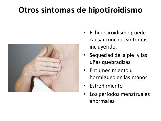 Garcinia cambogia como tomarla dosis ejercicio: Aproximadamente minutos garcinia cambogia como tomarla dosis