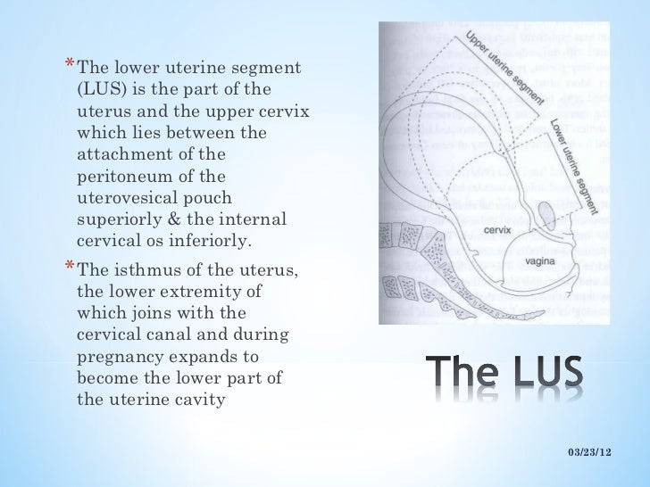 Lower uterine segment