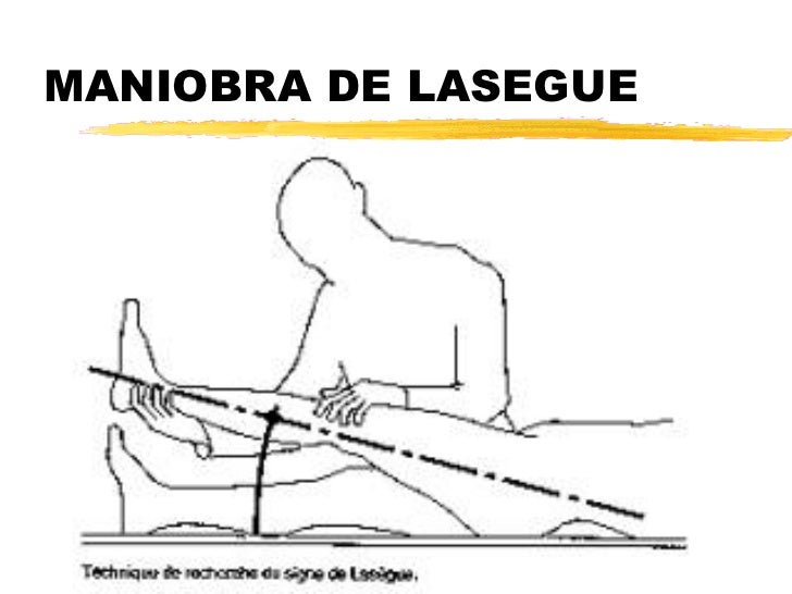Lumbalgia Lumbalgia