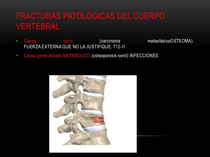 Cuantas veces hacer el masaje a la osteocondrosis
